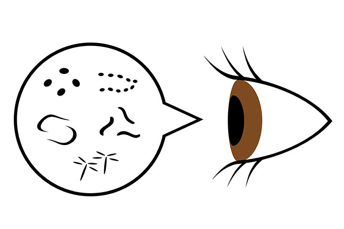 飛蚊症の見え方